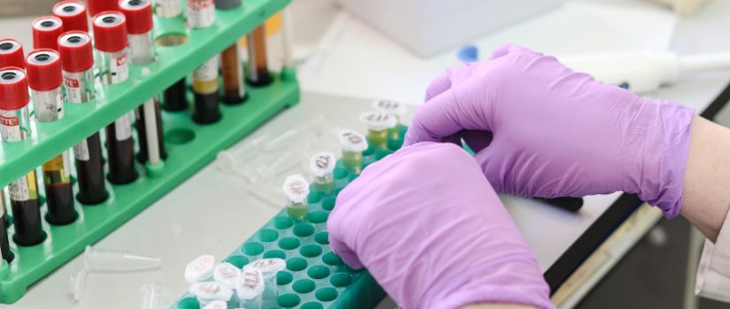 auxiliar de laboratorio